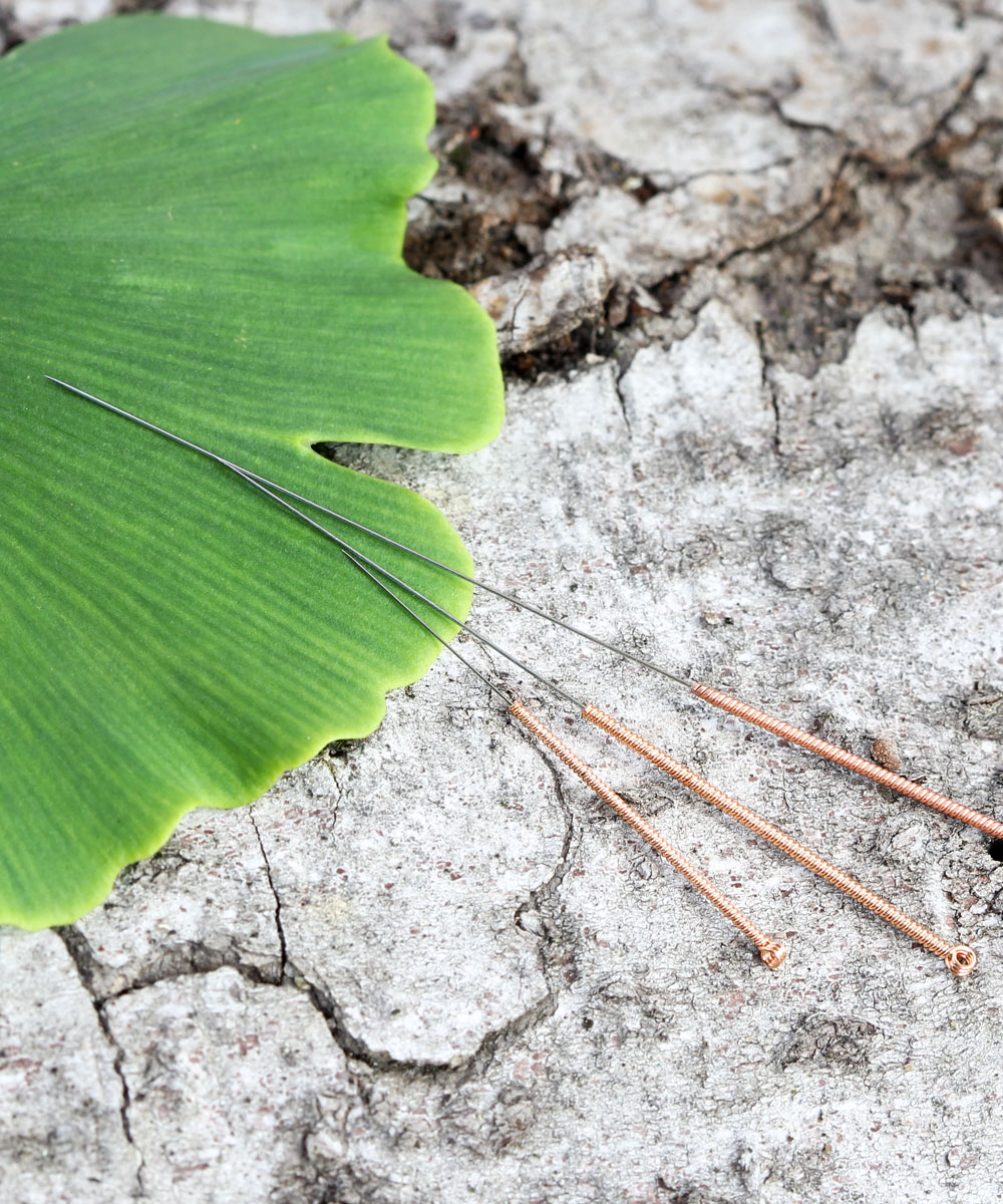 acupuncture_big